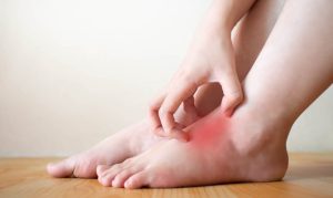 Problemas de piel y diabetes