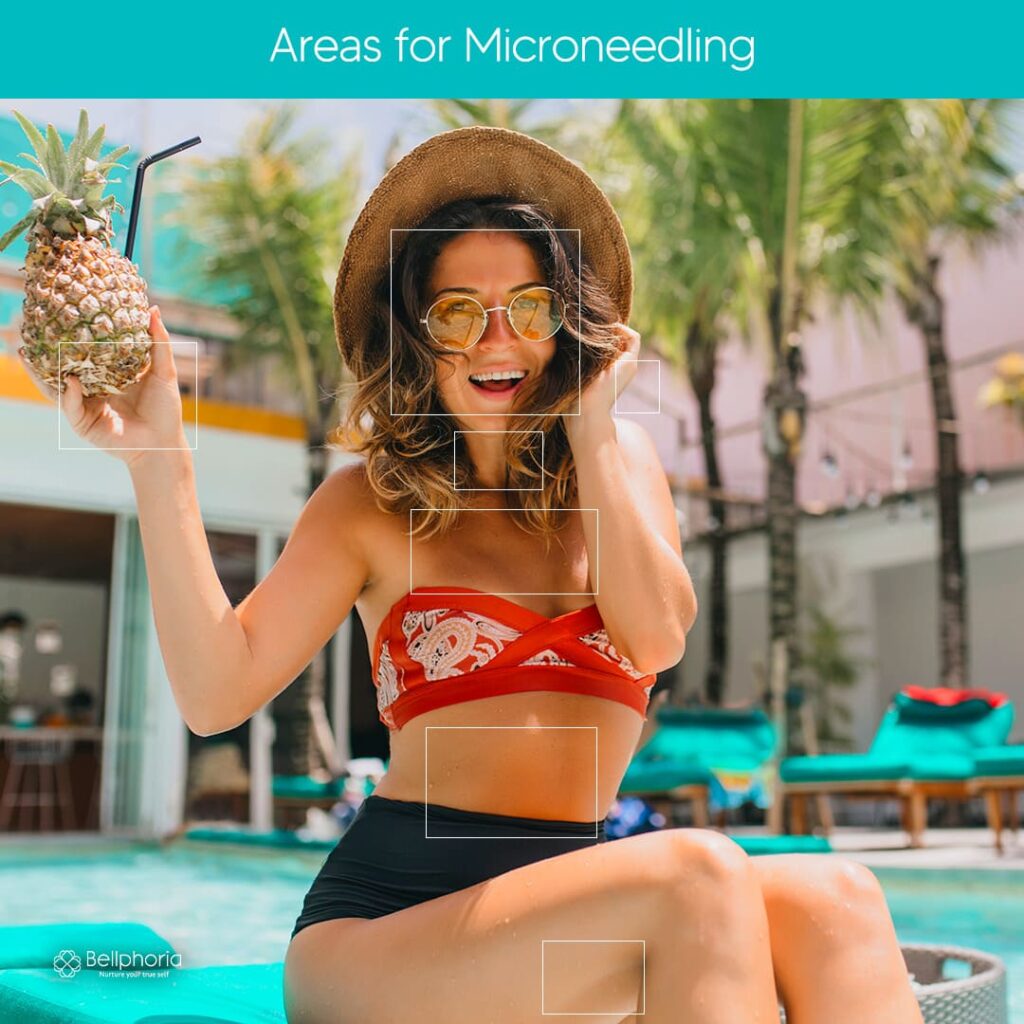Areas for microneedling or dermapen benefits near me